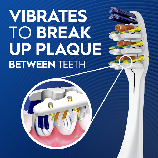 Oral-B Vibrating Pulsar Battery Toothbrush w/Microban, Plaque Remover for Teeth, Medium