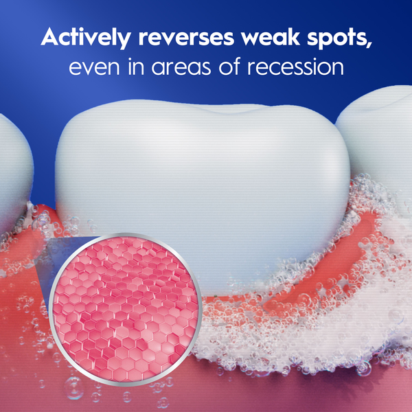 Crest Gum Recession Toothpaste Gum Protection even in areas of recession