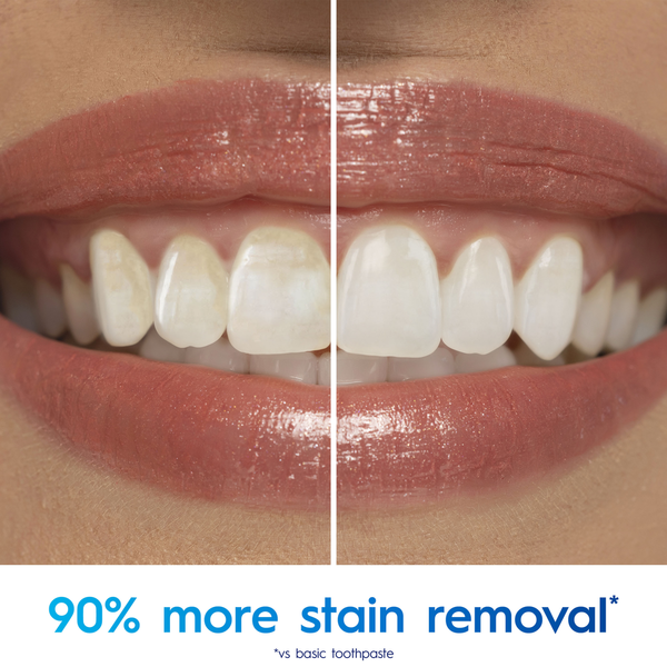 Crest Whitening Therapy Charcoal Deep Clean Invigorating Mint Teeth Whitening Toothpaste